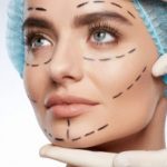 Saiba tudo sobre a técnica Deep Plane de cirurgia plástica facial