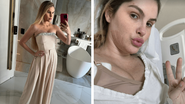 Bárbara Evans detalha novas cirurgias plásticas