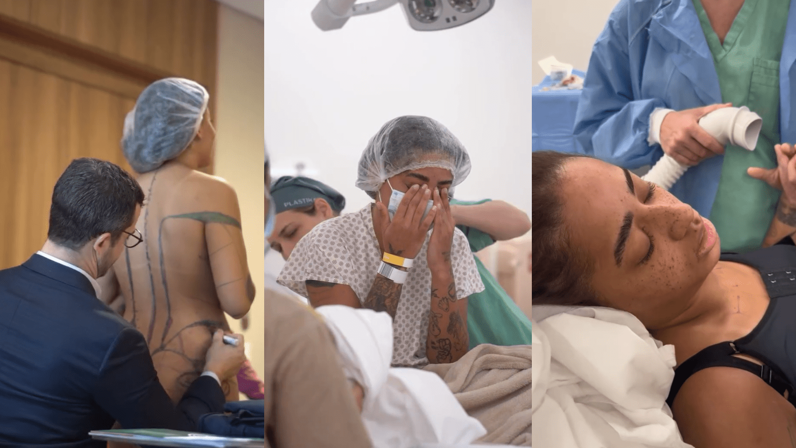 Em um vídeo, Loma mostrou como foi seu dia a caminho do hospital, o quarto em que ficou internada, as marcações feitas para a operação e cenas dos médicos fazendo os procedimentos no corpo da artista Em um vídeo, Loma mostrou como foi seu dia a caminho do hospital, o quarto em que ficou internada, as marcações feitas para a operação e cenas dos médicos fazendo os procedimentos no corpo da artista