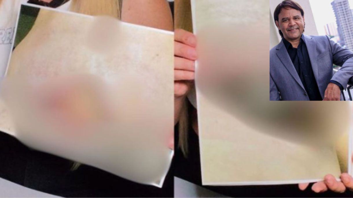 Deise Faria ficou com cicatriz necrosada na barriga e aberta no peito após procedimentos com médico Josias Caetano dos Santos